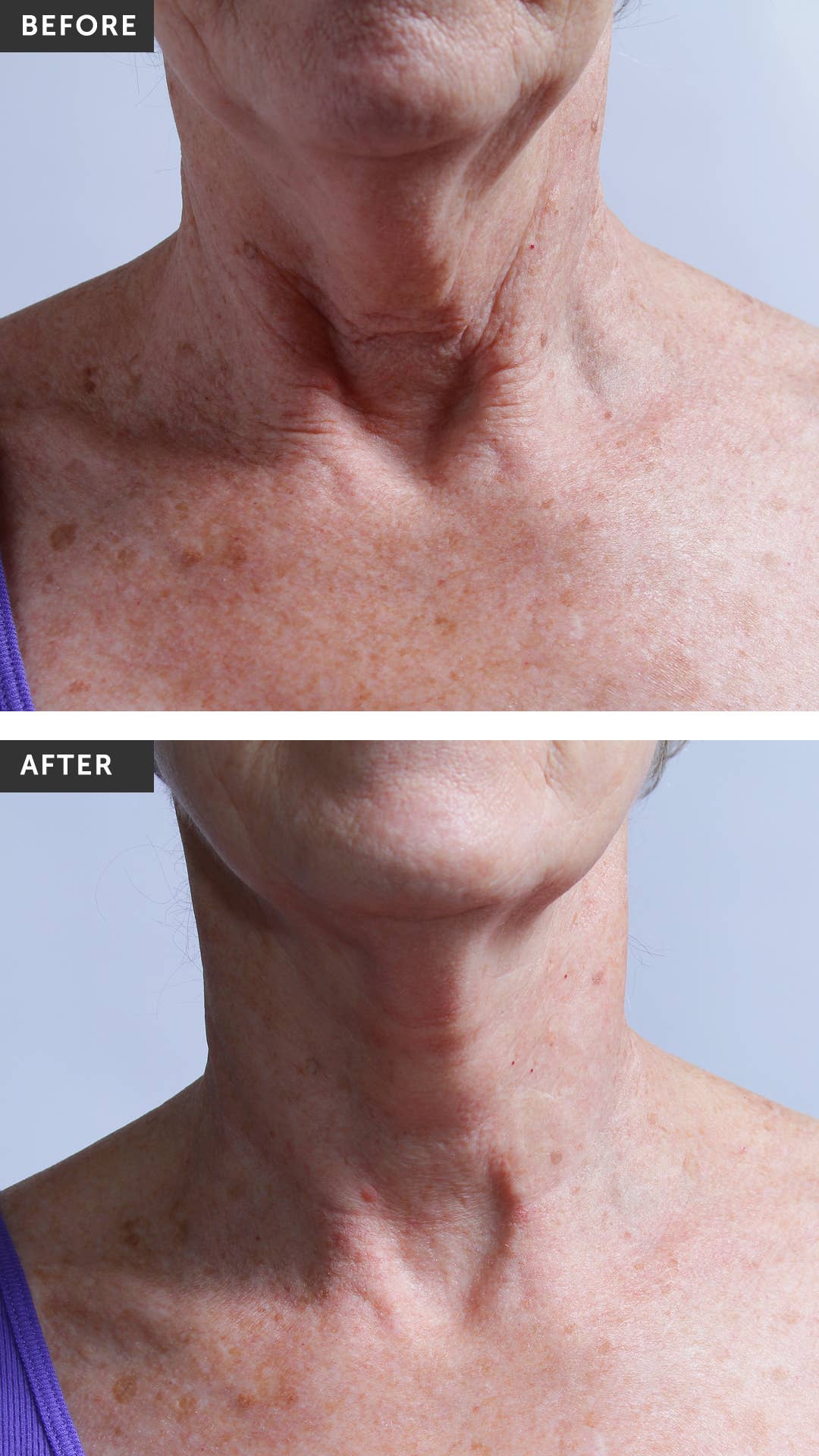 SilcSkin Collette Pads